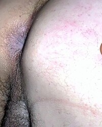 photo-thumb