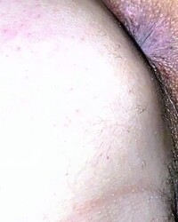 photo-thumb